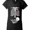 BABY XRAY